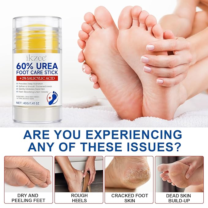 2Pack 60% Urea with 2% Salicylic Acid Foot Care Stick, Maximum Strength Urea Foot Cream Callus Remover for Dry Cracked Heels, Hands, Knees, Exfoliating Moisturizer, Dead Skin Remover Foot Balm