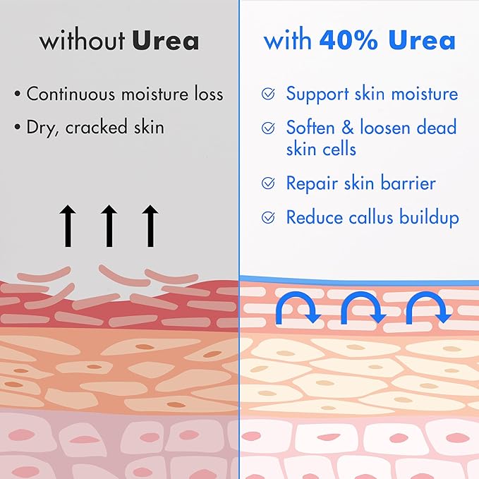 Ebanel Urea Cream 40% plus Salicylic Acid 2%, Foot Cream for Dry Cracked Heels Feet Knees Elbows Hands, Foot Dead Skin Cuticle Callus Remover Toenail Softener, Keratolytic Skin Barrier Repair