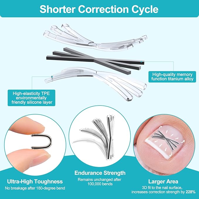 Ingrown Toenail Treatment Kit with Upgraded 6-Angle Shape,Titanium Alloy Ingrown Nail Corrector Tools with 4 Multi-Sizes,Ingrown Toe Nail Relief Remover Strips for Curved Toenail Quick Relief,8Pcs