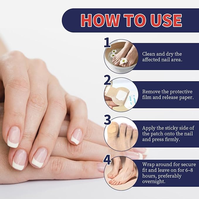 Toenail Fungus Treatment Extra Strength – 30 Pcs Fungal Nail Patches, Nail Fungus Patches for Toe Nail, Helps Improve Damaged & Discolored Nails, Overnight Renewal for Men and Women (strip)
