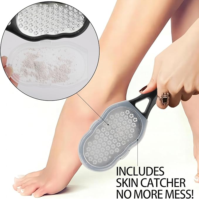 2 Pcs Foot Files with Skin Catcher, Stainless Steel Foot Rasp Callus Remover Pedicure Feet Grater Foot Scrubber Dead Skin Remover for Feet