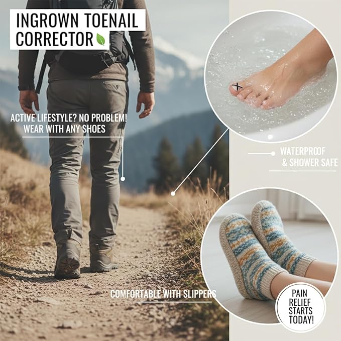 Ingrown Toenail Treatment Corrector Strips, Titanium Alloy Ingrown Nail Curve Corrector, Ingrown Toenail Tools for Home Use, 6Pcs
