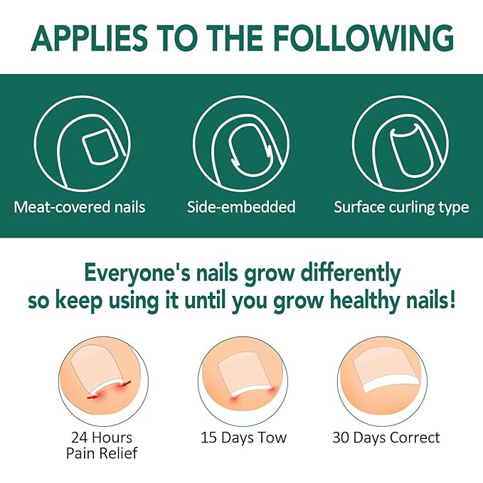 Ingrown Toenail Treatment, 100 Pcs Breathable Ingrown Toenail Strips, Toenail Corrector Patch with 3 Pedicure Tools for At-Home Pedicure and Foot Care (Style 02)