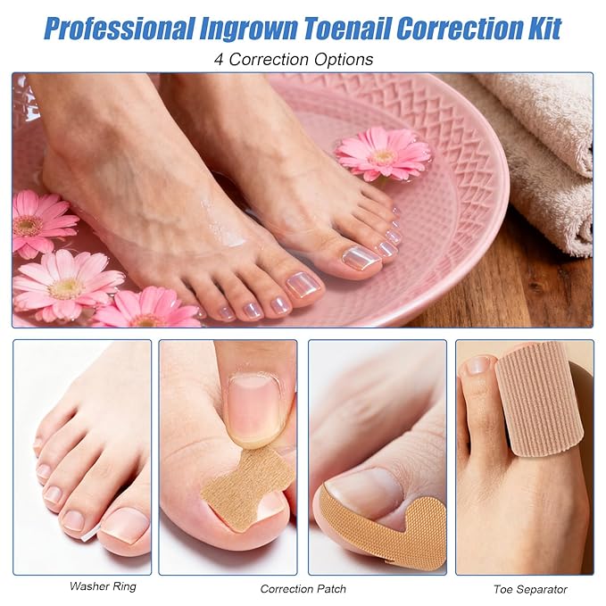 Professional Ingrown Toenail Removal Kit, Including Ingrown Toenail C-Shaped Patch Tools, Wide Nail Corrector Sticker, Correction Sticker Strips & Toe Separator, etc for Home Pedicure