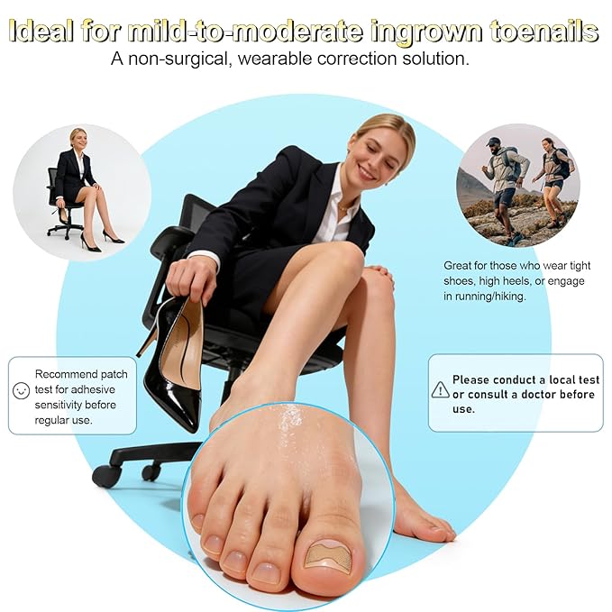 Ingrown toenail treatment，Breathable toenail correction patch, 50-piece package, can quickly repair toenails, using high-viscosity-grade glue, not easy to fall off, and easily solve toenail problems.