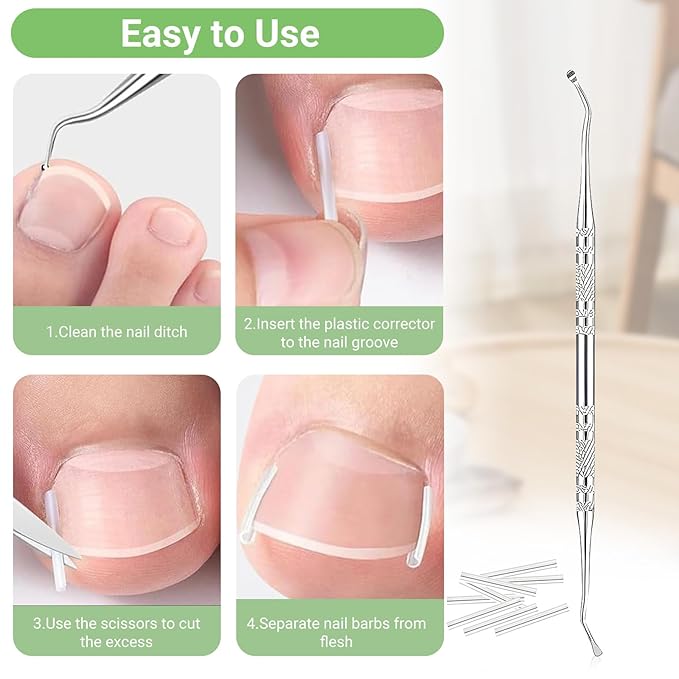 Ingrown Toenail Corrector Set with Correction Strips, Professional Toenail Tool Kit Includes Breathable Toenail Strips, Ingrown Toenails Pedicure Tool Set for Home Use (Silvery)