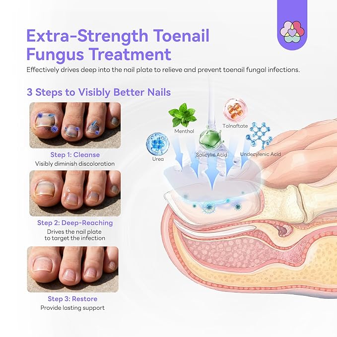 SAVILAND Toenail Fungus Treatment Extra Strength: 2X Extreme Nail Repair for Discolored and Damaged Nails Toenail Softener Yellow Toenail Foot Toe Thick Nail Fungus Treatments Solution 1 fl oz