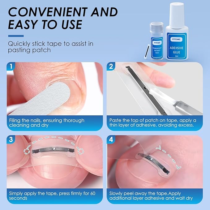 Titanium Ingrown Toenail Treatment,Ingrown Toenail Corrector for All Size Curve Correct, Nail Wraps & Nail Repair Products