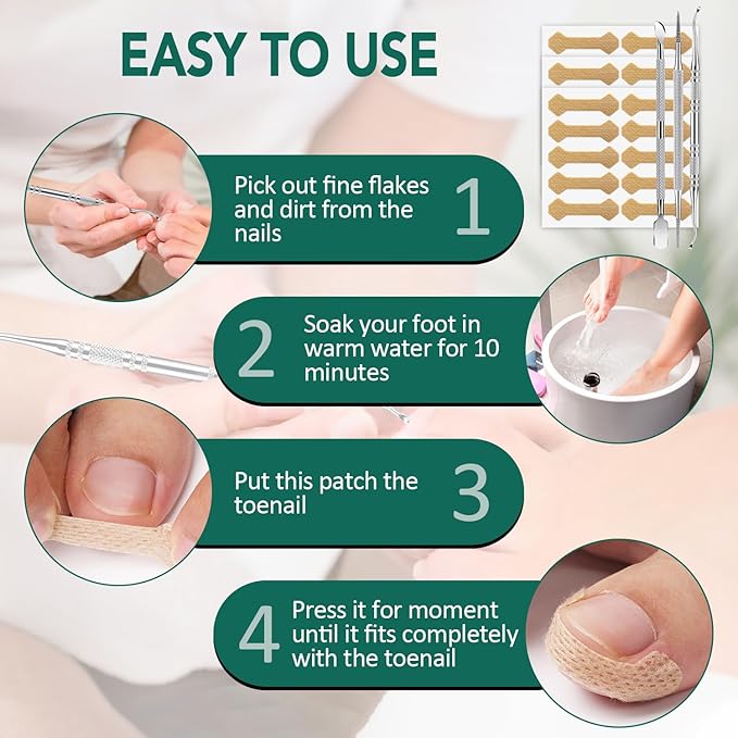 Ingrown Toenail Treatment, 100 Pcs Breathable Ingrown Toenail Strips, Toenail Corrector Patch with 3 Pedicure Tools for At-Home Pedicure and Foot Care (Style 04)
