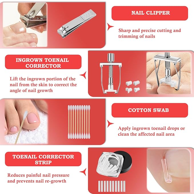 Ingrown Toenail Removal Kit, Professional Ingrown Toenail Treatment, Ingrown Toenail Tools Kit with Ingrown Toenail Corrector Drops, Toenail Clipper, Corrector Patch, Stainless Steel Pedicure Tool Set