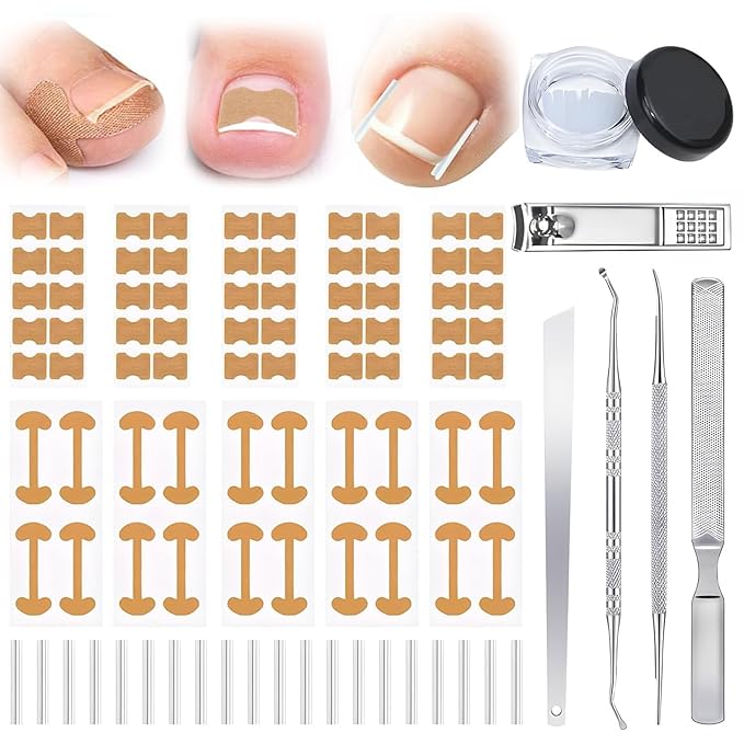 Ingrown Toenail Removal & Corrector Kit for Fast Pain Relief - Professional Ingrown Toenail Treatment Kit with Curved Strips, Breathable Patches & Pedicure Tools, Prevention & Healthy Nail Growth