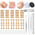 Ingrown Toenail Removal & Corrector Kit for Fast Pain Relief - Professional Ingrown Toenail Treatment Kit with Curved Strips, Breathable Patches & Pedicure Tools, Prevention & Healthy Nail Growth