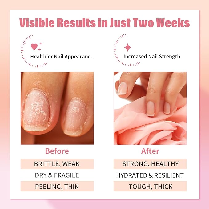 EJW Nail Strengthener - Growth & Conditioning Treatment for Thin, Weak, and Damaged Nails | 1.01 fl oz, Vegan & Cruelty-Free, Base Coat Compatible
