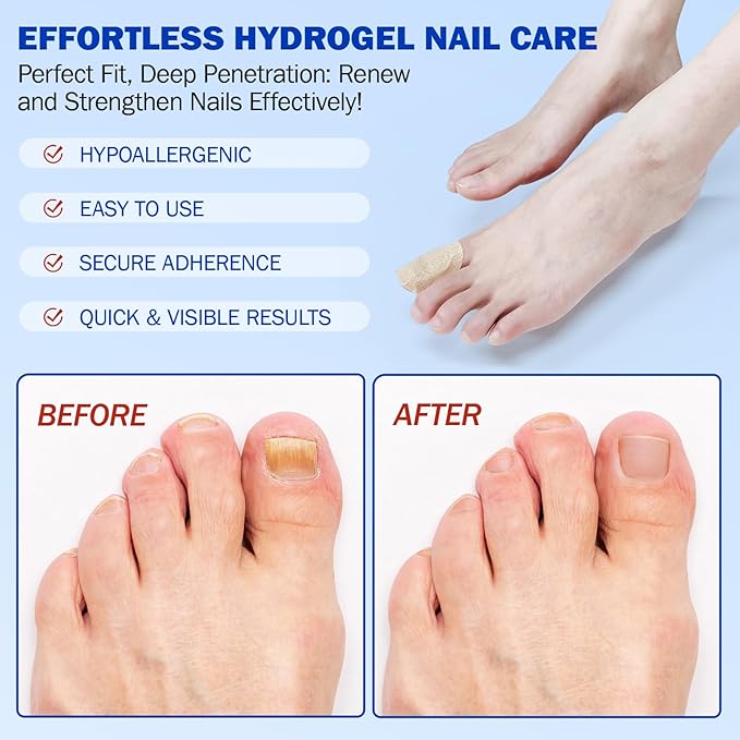 Fungal Nail Patches -Toenail Treatment Extra Strength 21Pcs- Nail Repair for Restores Damaged Nails and Appearance of Discolored