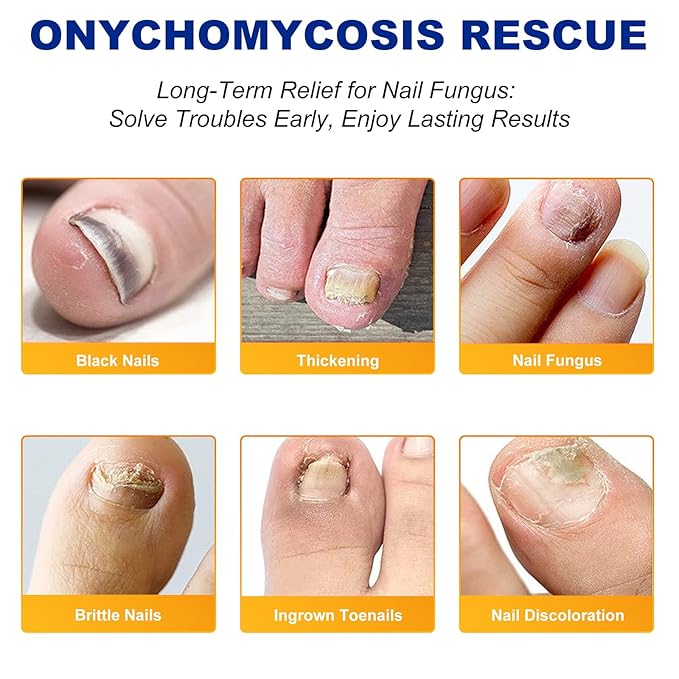 Nail Patches, Rapid Repair Hydrogel Nail Care Stickers, 8 Hours Results | Ultra-Thin and Breathable | Reduces Nail Discoloration | Repairs Damaged Nails, 64 PCS