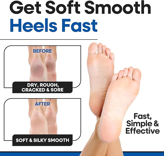 Moisturizing Socks for Mens Cracked Heels - Moisturizer Heel Sleeves to Smooth & Soften Rough Cracked Heels & Dry Feet. Large Aloe Moisturizing Heel Socks (White - 3 Pairs, Large)