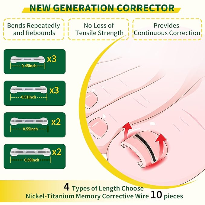 Small Size-Titanium Alloy Ingrown Toenail Treatment & Removal Kit for Quick Relief, Ingrown Toenail Removal Kit， Professional Ingrown Toenail Corrector, Ingrown Toenail Tools for Quick Relief, 10 Pcs