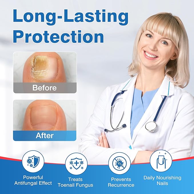 Toenail Fungus Treatment Extra Strength - DR.RAPID Toenail Fungus Treatment Pen with 25% Undecylenic Acid & Tolnaftate, Ideal for Nail Repair for Damaged Nails Toenail Fungus 5ml/0.18FLOZ 3Pcs