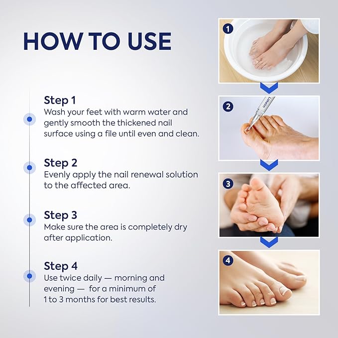 Toenail Fungus Treatment Extra Strength: 25% Undecylenic Acid & Tea Tree Oil - Repairs Yellow Thick Brittle Toe and Fingernails - 3 Pens with 5 Nail Files