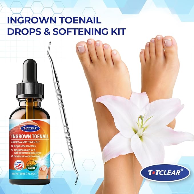 Ingrown Toenail Relief: Ingrown Toenail Tool for Men Women - Ingrown Toenail Removal Kit - Ingrown Toenail Corrector Drops - Ingrown Toenail Removal - Effective Solution for Ingrown Toenails - 30ml
