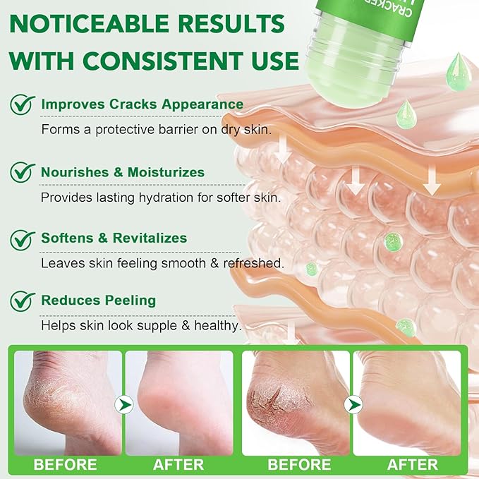 Peach+Aloe Scent Urea Cream 60% Plus Salicylic Acid 2% Foot Balm Stick for Dry Cracked/Chapped Heel, Skinned knees, Hand Intensively Hydration/Moisturization, Callus Removal/Softening/Soothing|40g+40g