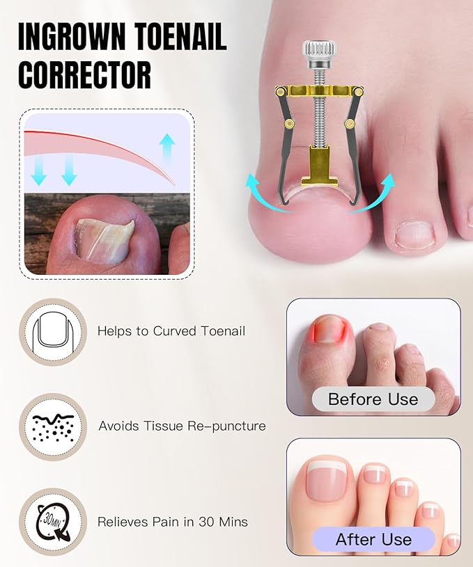 Toenail Clippers for Thick Nails - Ingrown Toenail Removal Kit - 12Pcs Podiatrist Grade Toe Nail Clippers for Seniors Men Women - Professional Home Pedicure Tools for Feet