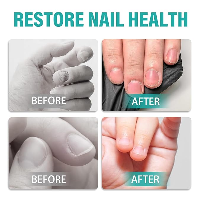 Nail Biting Treatment for Kids, Nail Biting Prevention, Effective Bitter Taste Help Stop Thumb Sucking, Safe Plant-Based Formula Nail Care Cream for Children and Adults