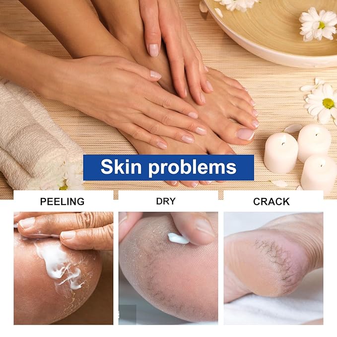 NovaCharm 45% Urea Cream with 2% Acid, Urea Foot Cream 45 Percent for Feet & Hands - Maximum Strength Foot Moisturizer for Rough, Dry, Thick & Cracked Skin, Callus Remover, Deep Hydration