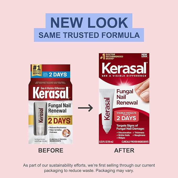 Kerasal Nail Fungus Extra Strength | Restorative Nail Repair for Damaged Nails, 0.33 fl oz (Packaging May Vary)