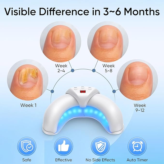 Home Toenail Repair Treatment for Multiple Toenails & Fingernails, Three Modes