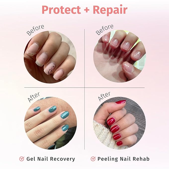 duri Rejuvacote 1 Original Maximum Strength Nail Growth System Base, Top Coat - Nails Hardening, Repair, Chipping, Strengthen, Breaking and Brittle Treatment (Pack of 6)