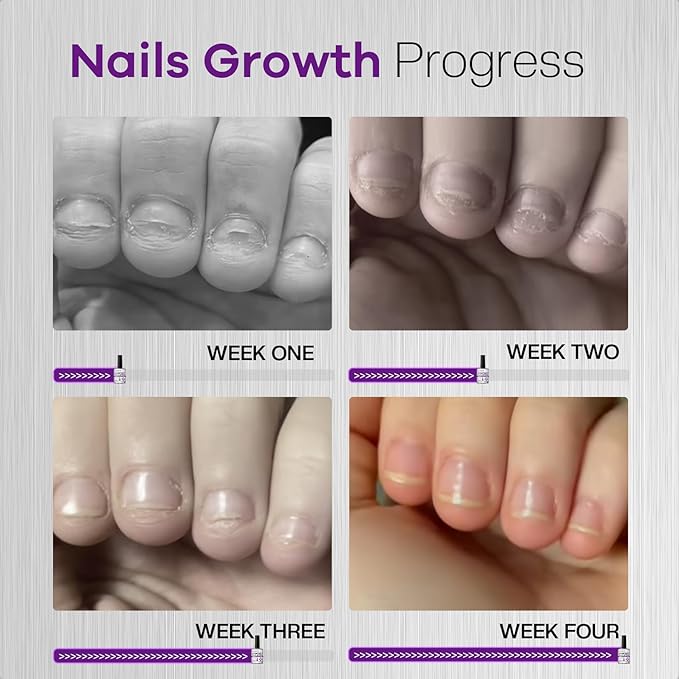 Stop Nail Biting Polish Extra Strength Formula Upgraded Bitterness Effective Anti-Biting Treatment for Adults Kids Bitter Nail Deterrent to End Thumb Sucking Water Resistant & Long Lasting