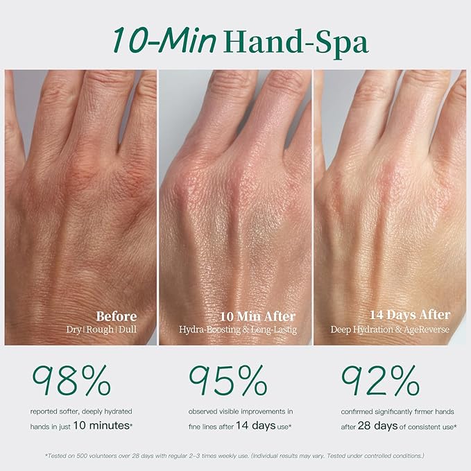 APUREE Anti Aging Hand Mask Gloves: 10-Minute Repair& Extra Moisture (5 * 30g)| for Severely Dry & Cracked Hands | Luxury Home SPA & 7 Peptides Collagen| All Skin Types| Vegan & Cruelty Free