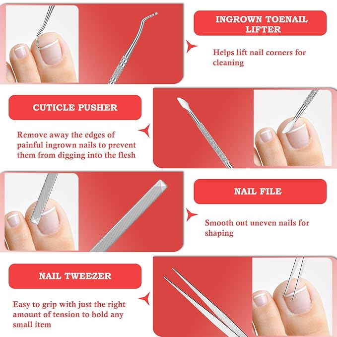 Ingrown Toenail Removal Kit, Professional Ingrown Toenail Treatment, Ingrown Toenail Tools Kit with Ingrown Toenail Corrector Drops, Toenail Clipper, Corrector Patch, Stainless Steel Pedicure Tool Set