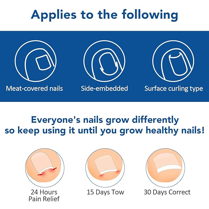 120pcs Ingrown Toenail Removal Kit, Professional Ingrown Toenail Corrector Kit, 3 Types Shaped Strips Toenail Stickers with 5 Pedicure Tools, Effective Removal of Ingrown Toenails