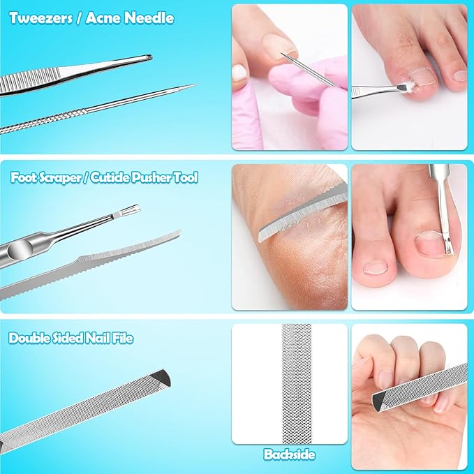 Modacraft 11-Piece Toenail Care Kit - Effective Ingrown Toenail Treatment with Toenail Clippers for Thick Toenails, Corrector & Other Pedicure Tools for Feet and Hand