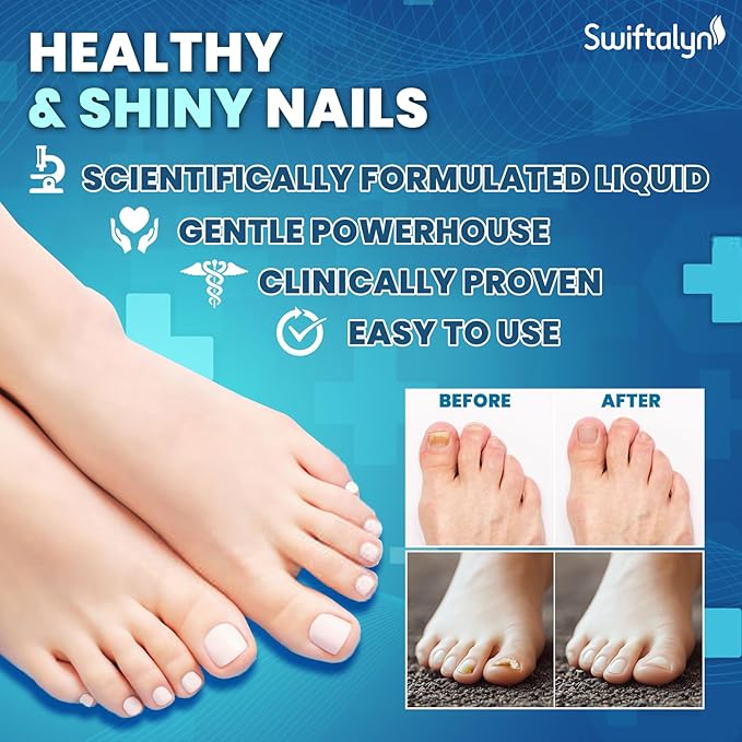 Nail Treatment For Toenails: Extra Strength Nail Solution with Brush for Toenails, Fingernails, Cuticles, Ingrown Nail Treatment - Fast Repair & Growth Formula 20ml