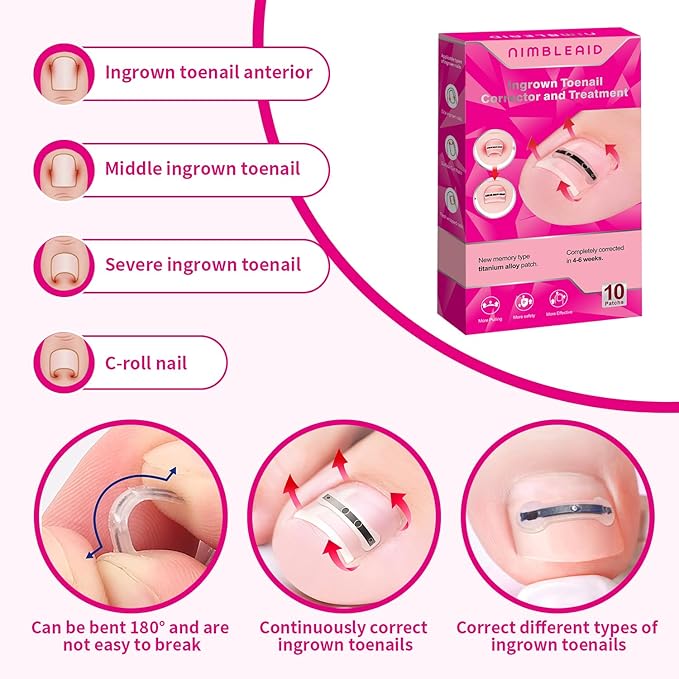 Titanium Alloy Ingrown Toenail Treatment & Corrector Kit - 3 Sizes Corrector for Men & Women Various Nail Sizes & Foot Types,Ingrown Toenail Removal Tool (10 Count-Small Size)