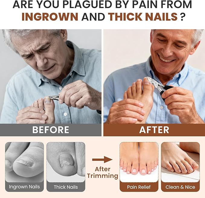 LIONVISON Ingrown Toenail Removal Kit: 8 Pcs Professional Toenail Clippers for Thick Toenails - Heavy Duty Nail Clippers Tools for Seniors Home Foot Care