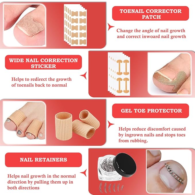 Ingrown Toenail Removal Kit, Professional Ingrown Toenail Treatment, Ingrown Toenail Tools Kit with Ingrown Toenail Corrector Drops, Toenail Clipper, Corrector Patch, Stainless Steel Pedicure Tool Set