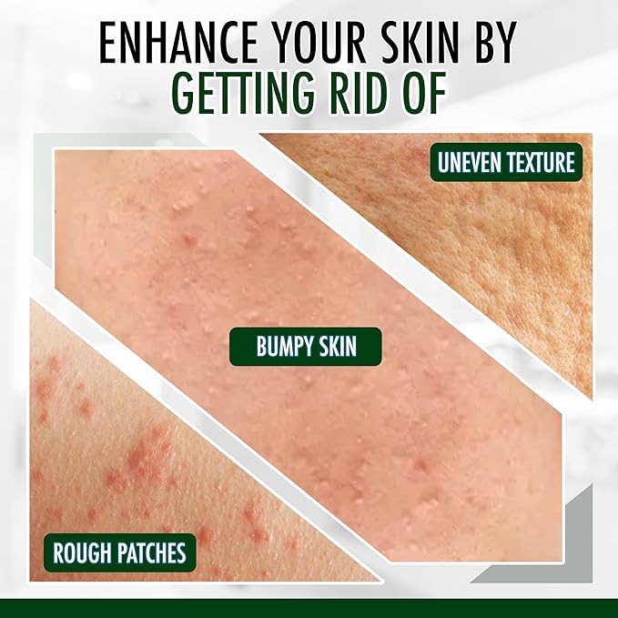 GLY MIRACLE Fragrance-Free Non-Greasy Body Lotion, 12 oz High-Glycerin Moisturizer for Sensitive, Extremely Dry Skin, Hands, Feet & Body