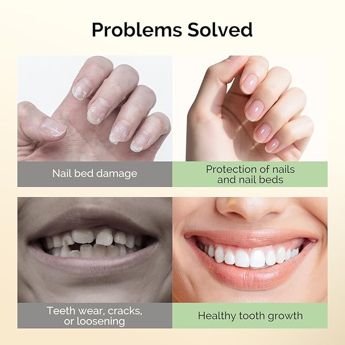 MelodySusie 15ML Nail Biting Treatment - Quick-Dry,Bitter-Tasting Polish to Stop Thumb Sucking & Nail Biting,Helps Repair Damaged Nails for Kids and Adults 0.53 fl oz