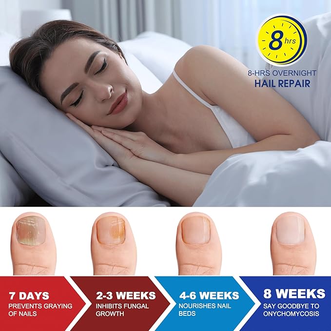 Toenail Fungus Treatment Extra Strength - 21 Pcs Fungal Nail Patches, nail repair patches-8-Hour Firm Adhesion, Nail Repair patches for Damaged Nails, Overnight Renewal for Men and Women