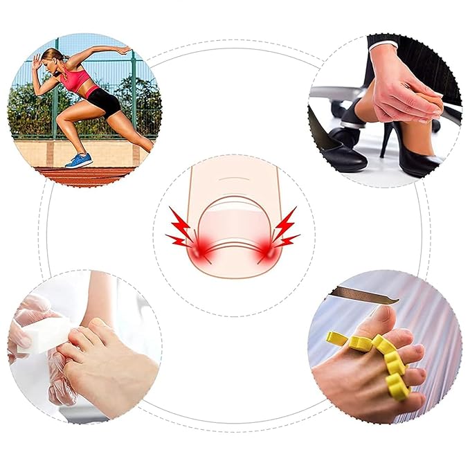 50 Pcs Ingrown Toenail Corrector Set, Toenail Correction Strips Brace Kit, Ingrown Toenails Correction Pad Recover Clips, Toenails Straightener Strips for Women Men's Nail Treatment Pedicure