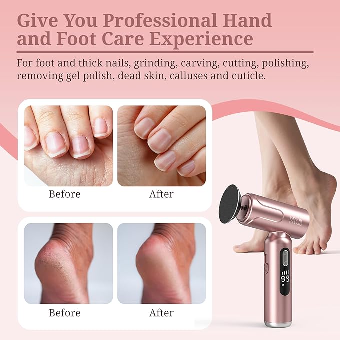 PELCAS Electric Foot Callus Remover with LED Screen, 2 in 1 Manicure & Pedicure Kit, 100 PCS Sandpapers Electric Foot File for Women & Men, Cordless Feet Filer for Foot Callus, Thick Nails Pink