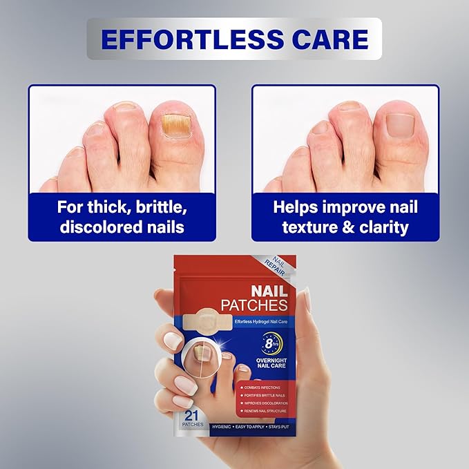 Fungal Nail Patches – 8-Hour Overnight Toenail Support for Nail Damage| Nighttime Repair Stickers 4 Pack (84 Paches)