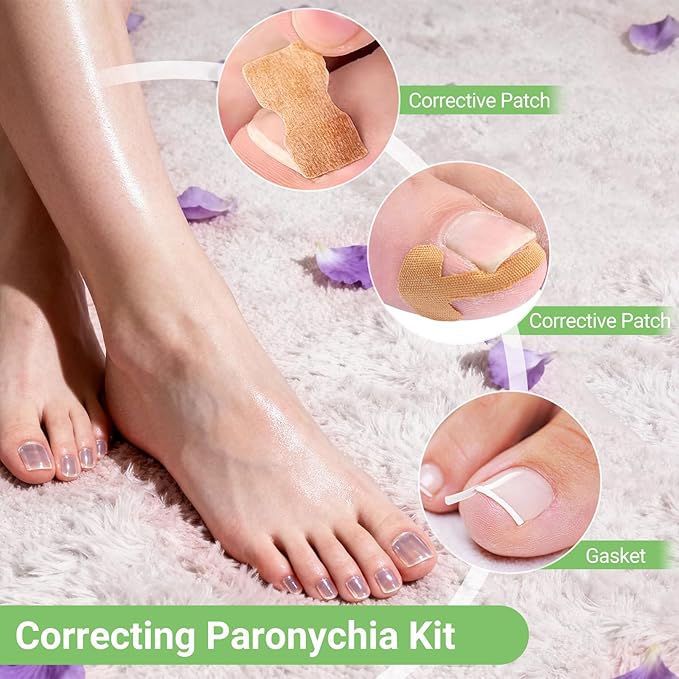 Ingrown Toenail Corrector Set with Correction Strips, Professional Toenail Tool Kit Includes Breathable Toenail Strips, Ingrown Toenails Pedicure Tool Set for Home Use (Silvery)