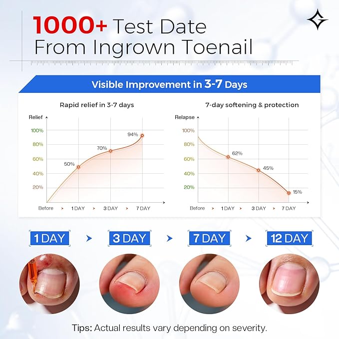 Ingrown Toenail Relief Kit: Professional 3-7 Day At-Home Ingrown Toenail Removal Drops With Ingrown Toenail Lifter & Self-Adhesive Bandage For Men Women, 30ml Softener For Hard Curved Nails