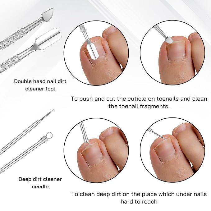 7 Pack Ingrown Toenail Tool Pedicure Tools for Feet, Stainless Steel Toenail Removal Kit, Professional Surgical Manicure Treatment Pedicure Tools for Feet Under Nail Cleaner Correction Polish Pain