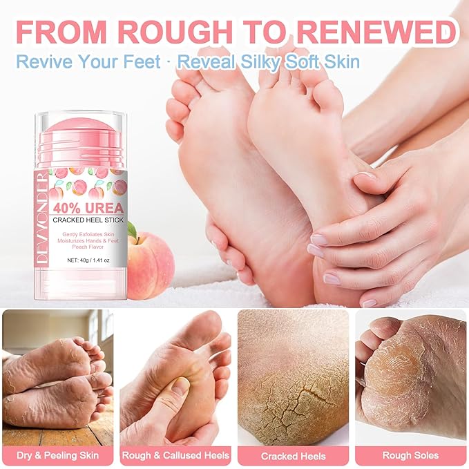 Urea Stick 40 Percent for Feet – Maximum Strength Heel Balm with 2% Salicylic Acid, Cracked Heel Treatment & Callus Remover, Hand & Foot Cream with Coconut Oil & Avocado Oil, Peach Flavor, 1.41 oz